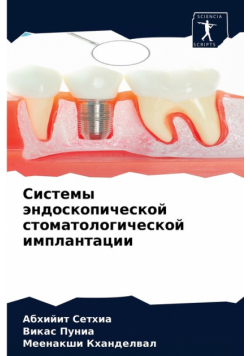 Системы эндоскопической стоматологической имплантации