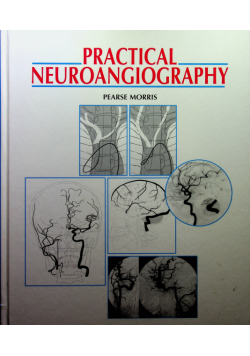 Practical neuroangigraphy