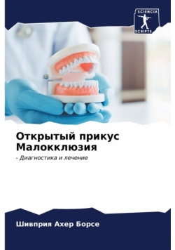 Открытый прикус Малокклюзия