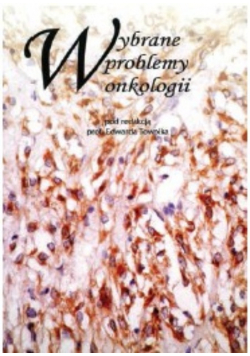 Wybrane problemy onkologii