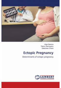 Ectopic Pregnancy