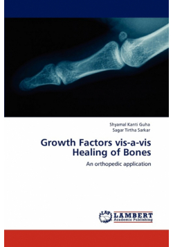 Growth Factors vis-a-vis Healing of Bones