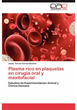 Plasma Rico En Plaquetas En Cirugia Oral y Maxilofacial