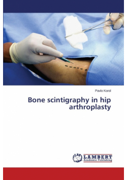 Bone scintigraphy in hip arthroplasty