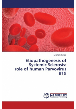 Etiopathogenesis of Systemic Sclerosis