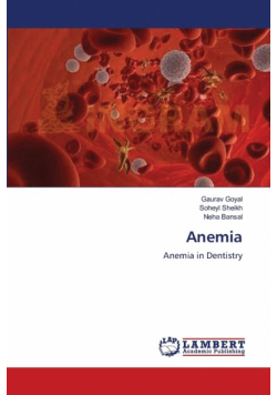 Anemia