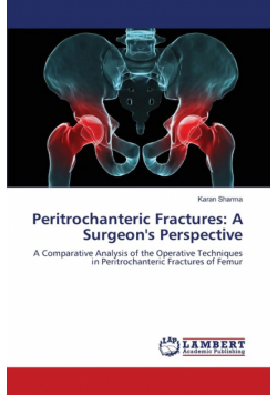Peritrochanteric Fractures