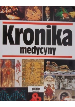 Kronika medycyny nowa z defektem