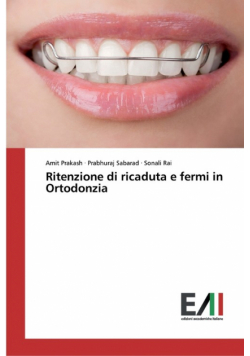 Ritenzione di ricaduta e fermi in Ortodonzia