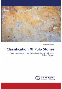 Classification Of Pulp Stones