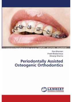Periodontally Assisted Osteogenic Orthodontics
