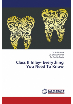 Class II Inlay- Everything You Need To Know