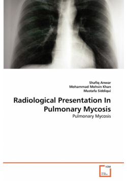 Radiological Presentation In Pulmonary Mycosis