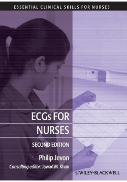 ECGs Nurses 2e