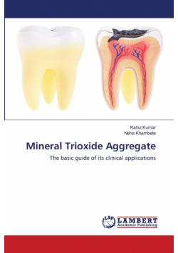 Mineral Trioxide Aggregate