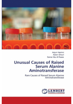 Unusual Causes of Raised Serum Alanine Aminotransferase