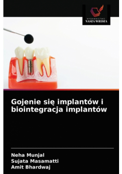 Gojenie się implantów i biointegracja implantów