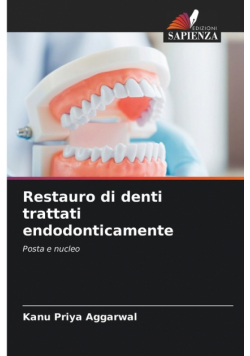 Restauro di denti trattati endodonticamente