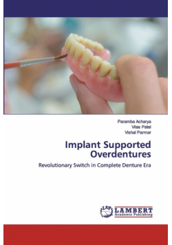 Implant Supported Overdentures