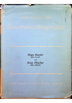An Atlas of electrocardiography