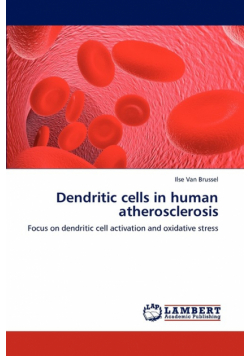 Dendritic Cells in Human Atherosclerosis