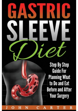 Gastric Sleeve Diet