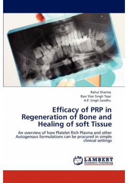 Efficacy of Prp in Regeneration of Bone and Healing of Soft Tissue