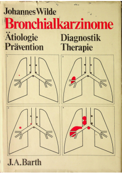 Bronchialkarziome