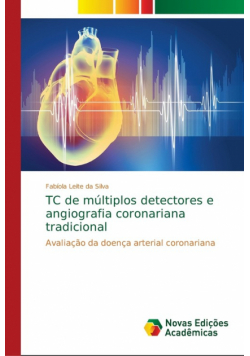 TC de múltiplos detectores e angiografia coronariana tradicional