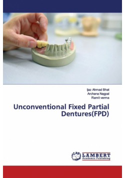 Unconventional Fixed Partial Dentures(FPD)