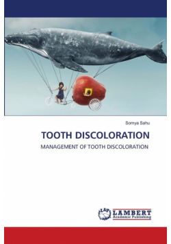 Tooth Discoloration