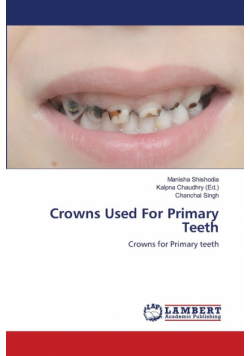 Crowns Used For Primary Teeth