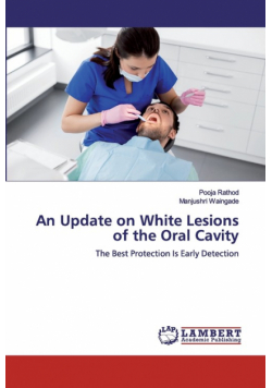 An Update on White Lesions of the Oral Cavity