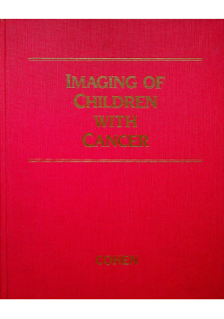 Imaging of children with cancer