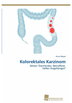 Kolorektales Karzinom