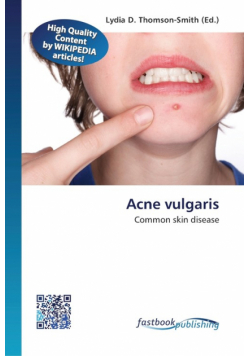 Acne vulgaris