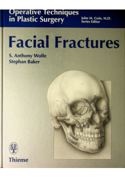Facial Fractures