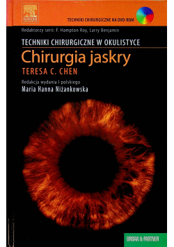 Chirurgia jaskry
