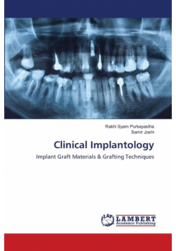 Clinical Implantology