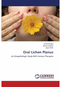 Oral Lichen Planus