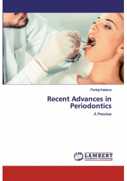 Recent Advances in Periodontics