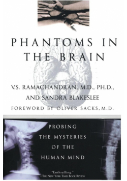 Phantoms in the Brain