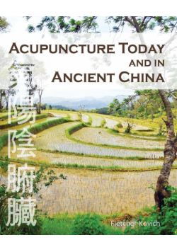 Acupuncture Today and in Ancient China