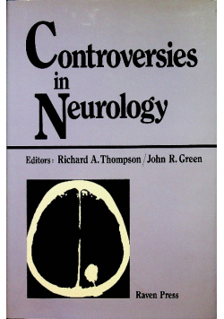 Controversies in Neurology