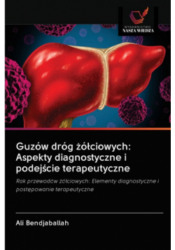 Guzów dróg żółciowych