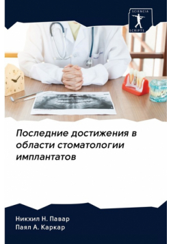 Последние достижения в области стоматологии имплантатов