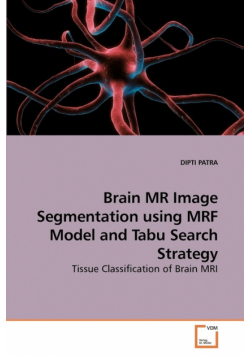 Brain MR Image Segmentation using MRF             Model and Tabu Search Strategy