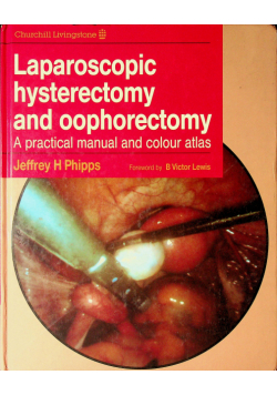 Laparoscopic Hysterectomy and Oophorectomy