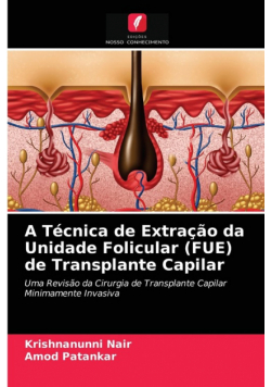 A Técnica de Extração da Unidade Folicular (FUE) de Transplante Capilar
