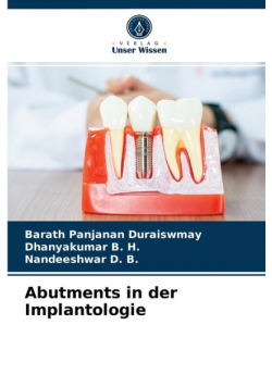 Abutments in der Implantologie